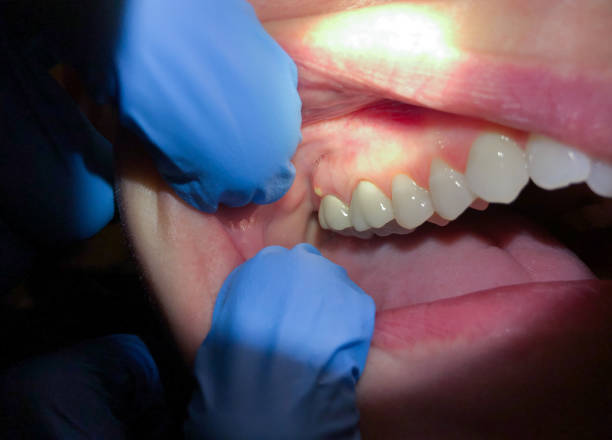 Best Mobile Emergency Dentist in Mcarthur, OH